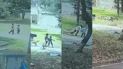 Bengaluru: Pack of stray dogs attack teenage girl in Air force campus in Jalahalli