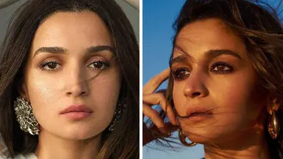 Did Alia Bhatt get botched Botox that paralysed her face? Actress explains