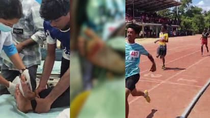 സ്പൈക്ക് ഇല്ലാതെ സിന്തറ്റിക് ട്രാക്കിൽ ഓടിയ കുട്ടികളുടെ കാലിലെ തൊലി അടർന്നു, സംഭവം ഉപജില്ലാ കായിക മേളക്കിടെ