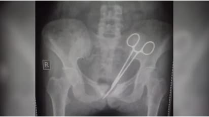 12 വർഷം അലട്ടിയ വയറ് വേദന, പല ഡോക്ടർമാരെയും കണ്ടിട്ടും കാര്യമുണ്ടായില്ല; ഒടുവിൽ കാരണം കണ്ടെത്തിയപ്പോൾ ഞെട്ടൽ