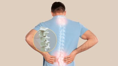 World Osteoporosis Day 2024: ഓസ്റ്റിയോപൊറോസിസിന്റെ ഈ ലക്ഷണങ്ങളെ തിരിച്ചറിയാതെ പോകരുത്