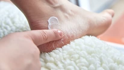 শীত এসে যাচ্ছে, ফাটা পায়ের যত্ন নিতে এবার বাড়িতেই এভাবে তৈরি করুন ময়েশ্চারাইজার