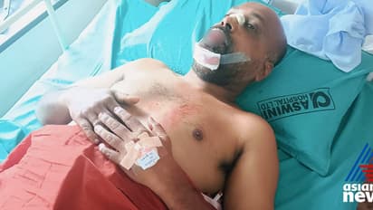 പൂങ്കുന്നത്ത് റോഡിലെ കുഴിയിൽ വീണ് സ്കൂട്ടർ യാത്രികന്റെ പല്ല് കൊഴിഞ്ഞു, താടിയെല്ലിനും പൊട്ടൽ