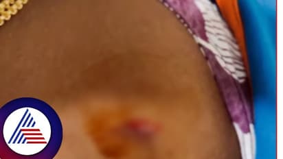 ಏನಾಗ್ತಿದೆ ಬೆಂಗಳೂರಲ್ಲಿ? ರಸ್ತೆಯಲ್ಲಿ ಮದ್ಯ ಸೇವನೆ ಮಾಡಿದ್ದನ್ನು ಪ್ರಶ್ನಿಸಿದ ದಂಪತಿಗೆ ಚಾಕು ಇರಿದ ಪುಂಡರು!