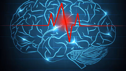 സ്ട്രോക്ക് സാധ്യതയെ തടയാന്‍ കഴിക്കേണ്ട ഭക്ഷണങ്ങള്‍