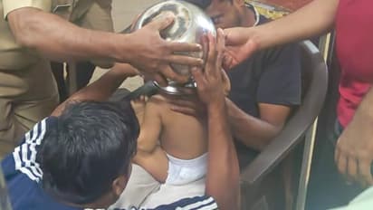 ഒന്നര വയസുകാരിയുടെ തലയിൽ പാത്രം കുടുങ്ങി, എറെ ശ്രമിച്ചും ഊരാനായില്ല, മണിക്കൂറുകൾ പരിശ്രമിച്ച് മുറിച്ചുമാറ്റി