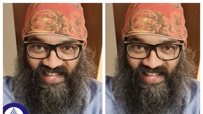 ಮೈ ತುಂಬ ತುರಿಕೆ, ಕೀವು.. ಗುರುಪ್ರಸಾದ್‌ಗಿದ್ದ ಆ ಕೆಟ್ಟ ಖಾಯಿಲೆ ಯಾವ್ದು ಗೊತ್ತಾ?