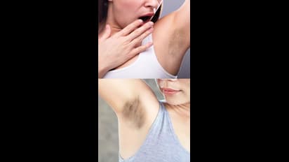 షేవింగ్ చేయకుండా.. చంకలో వెంట్రుకలు పోవాలంటే ఇలా చేయండి