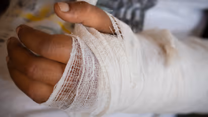 ഒടിഞ്ഞ് പ്ലാസ്റ്ററിട്ട കൈ വളഞ്ഞു, ആശുപത്രിക്കും ഡോക്ടർക്കുമെതിരെ വിധി, 60000 രൂപയും 5% പലിശയും നൽകണം