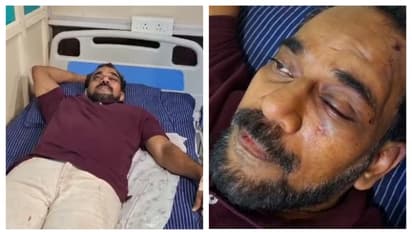 വടകരയിൽ അധ്യാപകന് ആറം​ഗസംഘത്തിന്റെ മർദനം; വാരിയെല്ലിനും കണ്ണിനും ​ഗുരുതരപരിക്ക്; സംഘത്തില്‍ വിദ്യാര്‍ത്ഥിയും