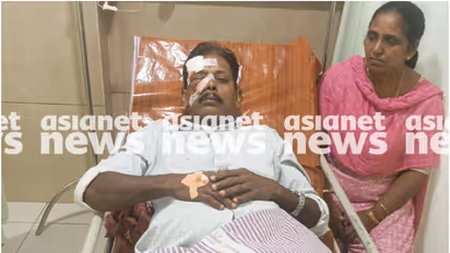 താമരശ്ശേരിയിൽ തെങ്ങിൻ മുകളിൽ ഒരു കുരങ്ങ്, കരിക്ക് പറിച്ച് കർഷകന് നേരെ ഒറ്റയേറ്; തലയ്ക്കും മുഖത്തും പരിക്കേറ്റു