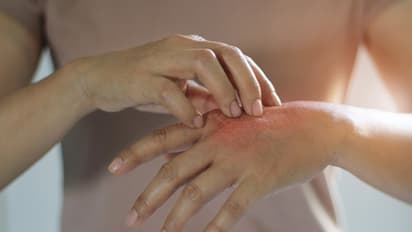 கொசுக்கடி கொல்லுதா? ஈஸியா கொசுவை விரட்டும் சூப்பர் டிப்ஸ்