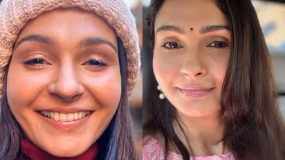 Andrea Jeremiah opens up about career break due to rare skin condition leaving eyebrows, eyelashes white