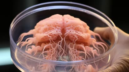 GROUNDBREAKING! Lab-grown 'mini human brains' can help cure Alzheimer's, Parkinson's & other killer disease
