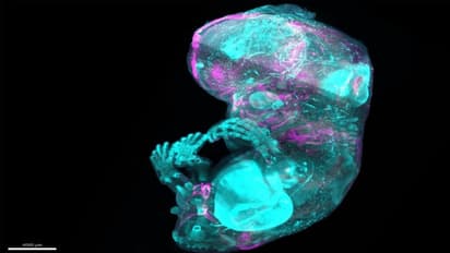 REMARKABLE! Human Cell Atlas maps all 37 trillion cells inside body, revolutionises disease research