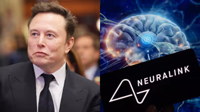 മനുഷ്യ ചരിത്രം മാറ്റിയെഴുതാന് ഇലോണ് മസ്ക്; മൂന്നാമതൊരാളിൽ കൂടി ന്യൂറാലിങ്ക് ഘടിപ്പിച്ചു