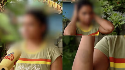 'സ്വർണം കൊണ്ടുവരാൻ പറഞ്ഞ് കഴുത്തിന് കുത്തിപ്പിടിച്ച് ശ്വാസംമുട്ടിക്കും'; നവവധുവിനെ ഭർത്താവ് മർദിച്ചെന്ന് പരാതി