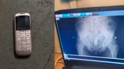 ಇಡಬಾರದ ಜಾಗದಲ್ಲಿ ಮೊಬೈಲ್ ಫೋನ್ ಅಡಗಿಸಿಟ್ಟ ಕೈದಿ: ಎಕ್ಸ್‌ರೇ ಮಾಡಿಸಿದ ಪೊಲೀಸರಿಗೆ ಶಾಕ್