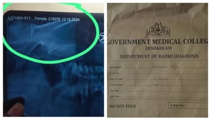 34കാരിക്ക് മരുന്ന് നൽകിയത് 64കാരിയുടെ എക്സ്റേ പ്രകാരം; കളമശ്ശേരി മെഡിക്കൽ കോളേജിൽ ചികിത്സാപ്പിഴവെന്ന് പരാതി