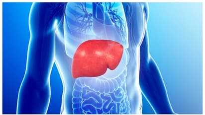 ആഴ്ചയില്‍ ഒരിക്കല്‍ മദ്യപിക്കുമോ? എങ്കില്‍ നിങ്ങളുടെ കരള്‍ ഇതുപോലെയാകും; 'ലിവർ ഡോക്ടർ' പങ്കുവച്ച ചിത്രം വൈറല്‍