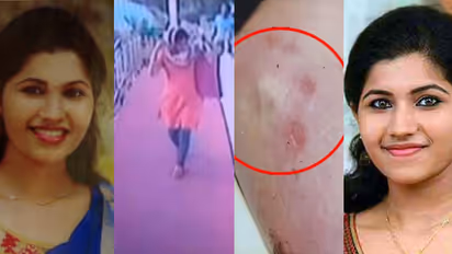 'മുഖത്തും ശരീരത്തിലും നഖം കൊണ്ട പാട്, ചുണ്ടിൽ മുറിവ്'; 7 വർഷമായി, മിഷേലിന്റെ മരണത്തിൽ നീതി കാത്ത് കുടുംബം