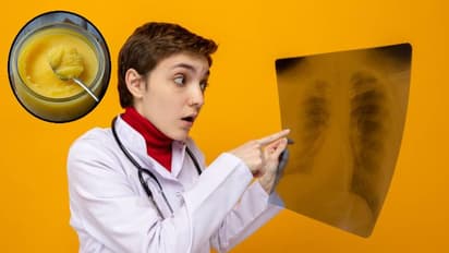 শিশুর নাকে ঘি দেওয়ার প্রথা দীর্ঘদিনের, কিন্তু তা কি আদৌ ঠিক? জানুন মারাত্মক ঝুঁকি