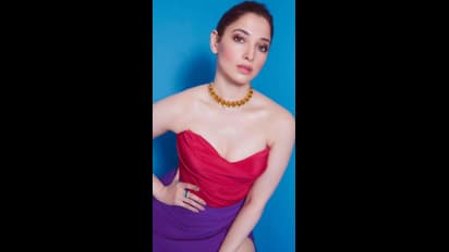 தமன்னாவின் காதலர் விஜய் வர்மாவுக்கு அரியவகை விடிலிகோ பிரச்சனை!