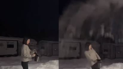 വൈറൽ ട്രെൻഡ് പരീക്ഷിച്ചു, ചൂടുവെള്ളം വീണത് യുവതിയുടെ ദേഹത്തേക്ക്, പൊള്ളലേറ്റു