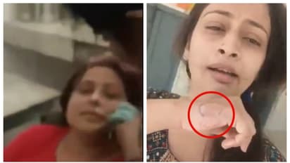 സ്കൂളിൽ വച്ച് ഫേഷ്യൽ മസാജ് ചെയ്യുന്ന വീഡിയോ എടുത്തതിന് ടീച്ചറെ കടിച്ച് പരിക്കേൽപ്പിച്ച് ഹെഡ്മിസ്ട്രസ്; വിവാദം 