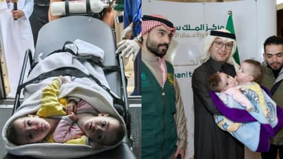 ഒരു മനസ്സാണെങ്കിലും ഇരുമെയ്യാകണം; പത്ത് മാസം പ്രായമുള്ള സെലീനും എലീനും റിയാദിലെത്തി