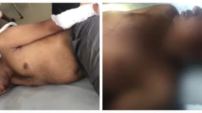 SHOCKING! Man stabbed 24 times in Kerala's Thrissur for not wishing assailant 'Happy New Year'