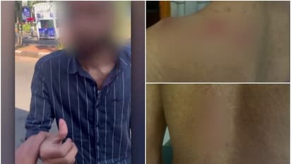 കരിപ്പൂർ എയർപോർട്ടിൽ ഉംറ തീർത്ഥാടകന് ക്രൂരമർദ്ദനമെന്ന് പരാതി