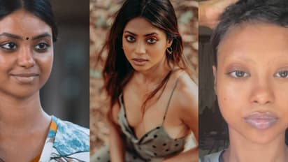 തലമുടി പോയി, തുടര്ന്ന ഇഞ്ചക്ഷന്: രോഗ അവസ്ഥ പറഞ്ഞ് 'കമ്മട്ടിപ്പാടം' നായിക ഷോണ് റോമി