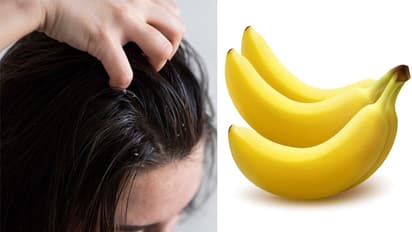 চুলের খুশকি দূর করার ঘরোয়া টোটকা,  কলার হেয়ার মাস্কেই কেল্লাফতে