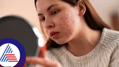 ವಯಸ್ಸಾದ ಬಳಿಕ ಕಾಡುವ ಸುಕ್ಕಿನ ತ್ವಚೆ, ಹಾರ್ಮೋನ್‌ ಬದಲಾವಣೆಯಿಂದಾಗುವ ಮೊಡವೆಗಳಿಗೆ ಇಲ್ಲಿದೆ ಪರಿಹಾರ 