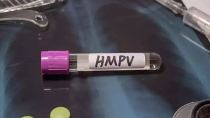 சென்னையில் 2 குழந்தைகளுக்கு HMPV தொற்று! பீதியில் பொதுமக்கள்!