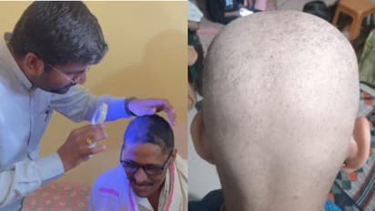 ഒന്നു തൊട്ടാൽ മതി, മുടിയെല്ലാം കൊഴിഞ്ഞുവീഴുന്നു; നിരവധിപ്പേർക്ക് തലയിൽ ഒരു മുടി പോലുമില്ലാതായത് ഒരാഴ്ച കൊണ്ട്