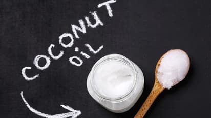 చలికాలం కొబ్బరి నూనె గడ్డ కడుతోందా.? ఇలా చేయండి.. 