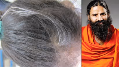 ಈ ನಾಲ್ಕೇ ನಾಲ್ಕು ಟಿಪ್ಸ್ ಪಾಲಿಸಿದ್ರೆ ನಿಮ್ಮ ತಲೆಗೂದಲು ಕಪ್ಪಾಗೋದು ಗ್ಯಾರಂಟಿ