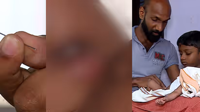 ഗുരുതരപിഴവ്! 25ദിവസം പ്രായമുള്ള കുഞ്ഞിന്റെ കാലിൽ സൂചി; പരിയാരം മെഡിക്കൽ കോളേജിനെതിരെ മുഖ്യമന്ത്രിക്ക് പരാതി