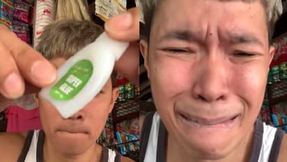 എന്റമ്മോ ഇത് സത്യമാണോ? വീഡിയോ കണ്ടവർ കണ്ടവർ ചോദിക്കുന്നു, ചുണ്ടിൽ സൂപ്പർഗ്ലൂ തേച്ച് യുവാവ്