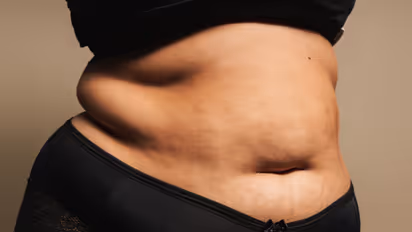 സ്ത്രീകള് വയറിലെ കൊഴുപ്പിനെ പുറംതള്ളാന് ഡയറ്റില് നിന്നും ഒഴിവാക്കേണ്ട ഭക്ഷണങ്ങള്