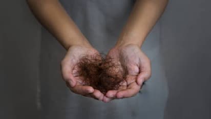 ९ वर्षीय मुलीच्या पोटात १.५ किलो केस सापडले