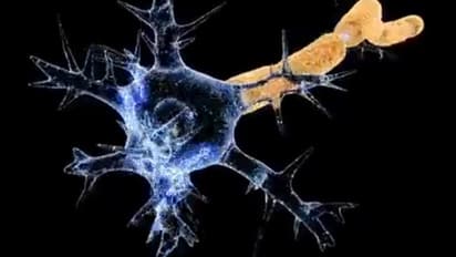 സ്വകാര്യ ആശുപത്രിയിൽ ഒരു കുത്തിവയ്പ്പിന് 20,000 രൂപ ചെലവ്; ഗില്ലന് ബാരെ സിന്ഡ്രം പടരുമ്പോൾ വലിയ ആശങ്ക