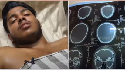 എബിവിപിയുടെ രക്തദാനക്യാമ്പിൽ പങ്കെടുത്തില്ല; വിദ്യാർത്ഥിയെ ക്ലാസ് മുറിയിലേക്ക് കൊണ്ടുപോയി, ക്രൂര മർദ്ദനം