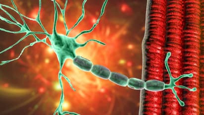 പൂനെയിൽ ആശങ്കയായി ഗില്ലൻ ബാരി സിൻഡ്രോം; ആശുപത്രിയില്‍ പ്രവേശിപ്പിച്ചവരുടെ എണ്ണം 100 കവിഞ്ഞു