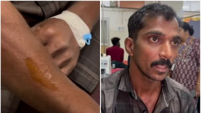 വയനാട്ടിൽ വീണ്ടും വന്യജീവി ആക്രമണം; റാട്ടകൊല്ലിയിൽ യുവാവിനെ പുലി ആക്രമിച്ചു