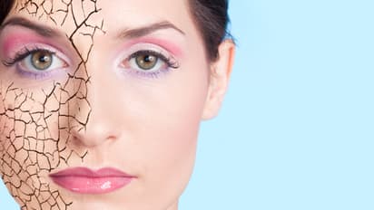 വരണ്ട ചര്മ്മത്തെ അകറ്റാന് ഡയറ്റില് ഉള്പ്പെടുത്തേണ്ട ഭക്ഷണങ്ങള്