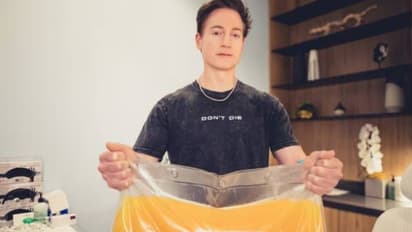 ആർക്കെങ്കിലും വേണോ? പ്രായം കുറക്കാൻ പ്ലാസ്മ തരാൻ തയ്യാറെന്ന് ടെക് കോടീശ്വരൻ, ചോദ്യങ്ങളുമായി നെറ്റിസണ്സ്