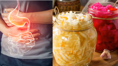 ദഹനം മെച്ചപ്പെടുത്താന് കഴിക്കേണ്ട പ്രോബയോട്ടിക് ഭക്ഷണങ്ങള്